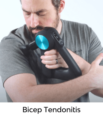 Bicep Tendonitis Bicep Tendonitis
